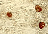 Chlamydia trachomatis, Einschlussk�rperchen