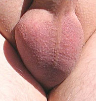 Rasierter Hodensack kalt