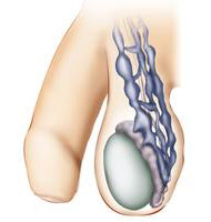 Unfruchtbarkeit bei M�nnern