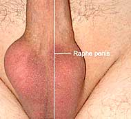 Raphe penis - Penisnaht
